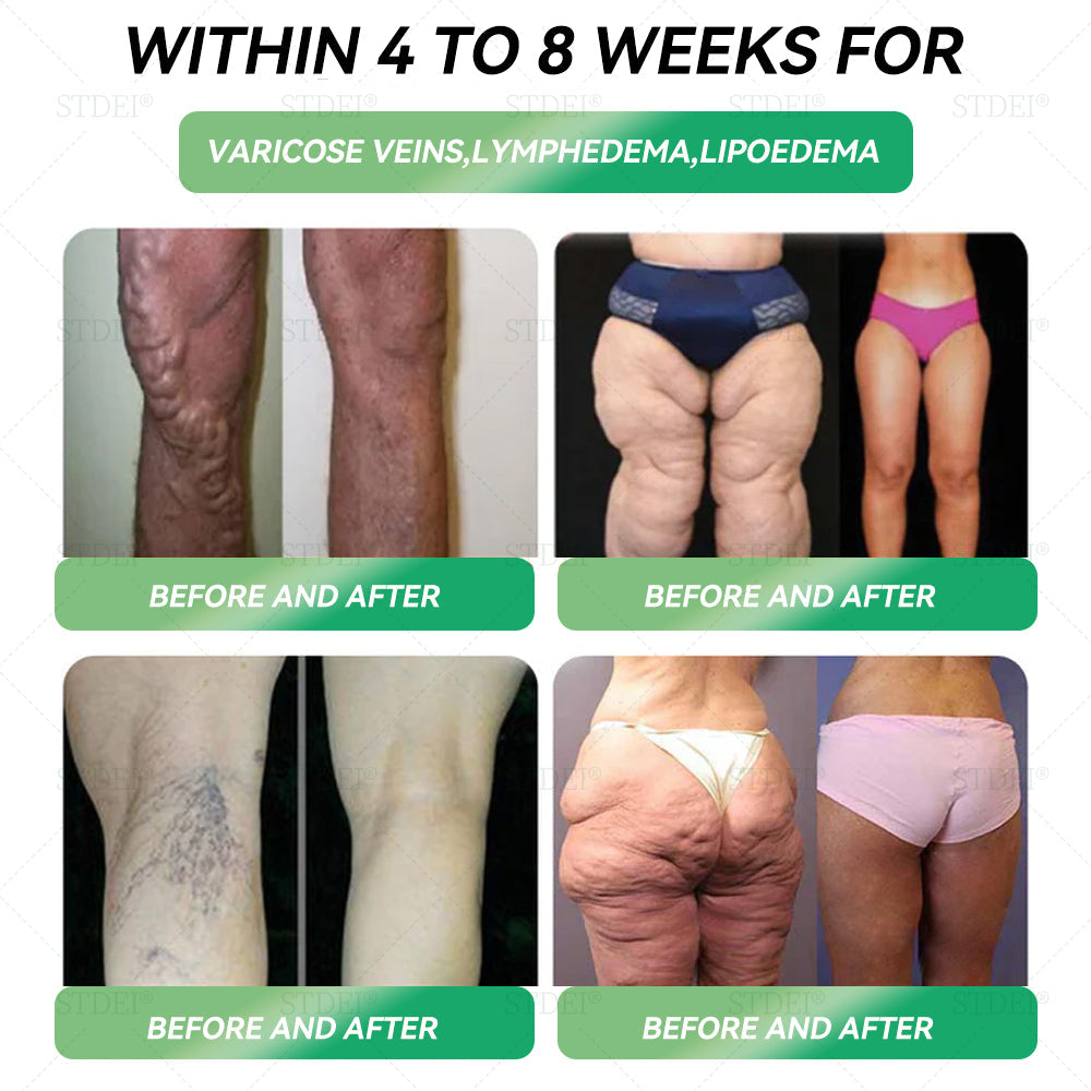 Recommended by leading U.K. clinics | Official Store | 𝑆𝑇𝐷𝐸𝐼® 𝐺𝐿𝑃-1  𝑂𝑟𝑎𝑙 𝑆𝑜𝑙𝑢𝑡𝑖𝑜𝑛 ⏳ Visible results within 7 days (Targeting 𝑜𝑏𝑒𝑠𝑖𝑡𝑦, 𝑙𝑦𝑚𝑝ℎ𝑒𝑑𝑒𝑚𝑎, 𝑑𝑖𝑎𝑏𝑒𝑡𝑒𝑠, 𝑎𝑛𝑑 ℎ𝑒𝑎𝑟𝑡-𝑟𝑒𝑙𝑎𝑡𝑒𝑑 𝑐𝑜𝑛𝑑𝑖𝑡𝑖𝑜𝑛𝑠)